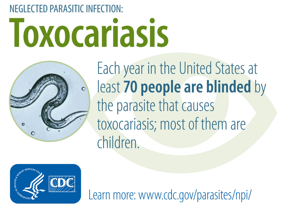 toxocariasis_infographic
